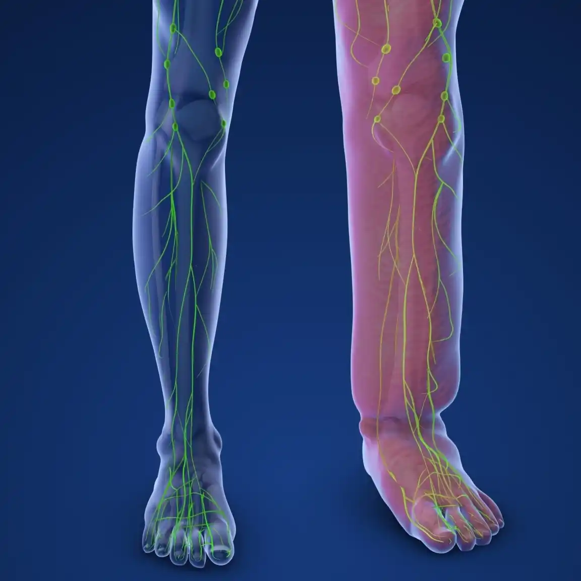 Λεμφοίδημα